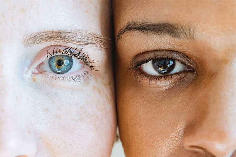 بررسی دلایل ریزش مژه