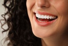 برای زیبایی دندان چه کار کنیم