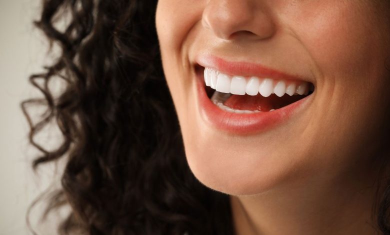 برای زیبایی دندان چه کار کنیم