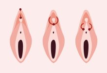 پیرسینگ واژینال چیست